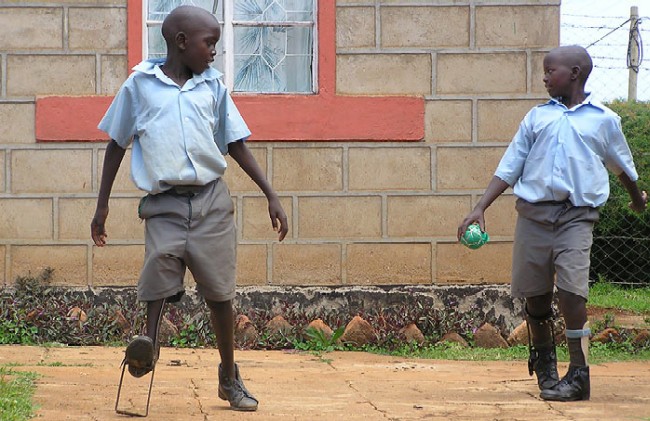  Mit Prothesen und Orthesen wird den Kindern die Mglichkeit gegeben, wieder am Alltagsleben teilzuhaben und auch wieder Fuball zu spielen